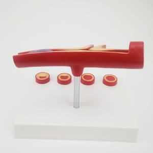 Demonstrador de Arteria Tipo Y DARHMMY - Material de PVC con Aterosclerosis y Trombosis para Educación y Entrenamiento Médico - Product Image 4