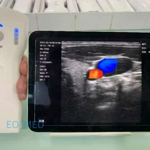 Échographe vétérinaire portable sans fil couleur Doppler 3-en-1 à 64 canaux de pointe pour Windows, iOS, Android DCU19H - Product Image 6