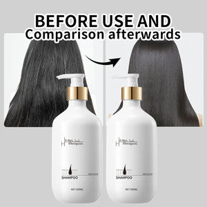 Champú Nutritivo Unisex para <span class=keywords><strong>Cabello</strong></span> Graso, Desenredante, Anticaspa, Hidratante, Estimulante del Crecimiento y Anticaída, para Salón de Belleza - Product Image 3