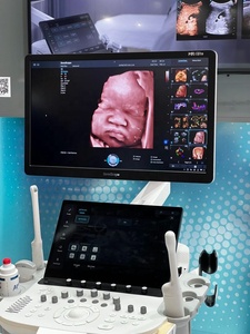 Échographe Doppler Couleur 3D/4D Professionnel SonoScape Propet 80 de Haute Qualité avec Logiciel Vétérinaire pour Hôpitaux et Cliniques - Product Image 1