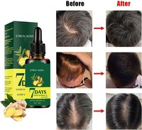 ETRUN ALISA Marque privée Huile de croissance des cheveux au gingembre 100% naturelle Sérum germinal au gingembre contre les pointes fourchues et les démangeaisons 7 jours