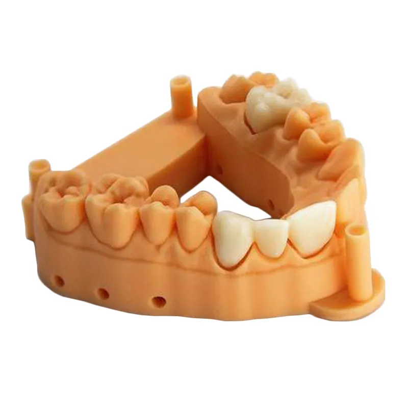 Nach Dental SLA 3D druck medizinische modell Medizinische grade harz zähne implantat modell