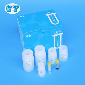 자석 구슬 핵산 적출 장비 RNA 고립 DNA 정화 실험실 시약 - Product Image 2