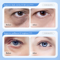 Set de Cuidado Facial Reafirmante Antiarrugas con Ácido Hialurónico SADOER8D - Limpiador Facial, Crema para Ojos, Oferta al por Mayor