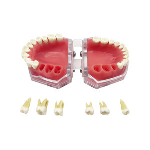 نموذج أسنان مع أسنان قابلة للإزالة، نموذج تدريبي لاستخراج الأسنان، نموذج أسنان جديد لتعليم المرضى والعروض التوضيحية - Product Image 4