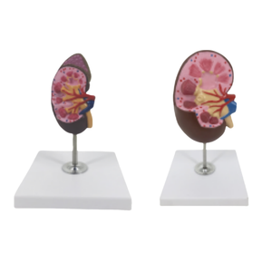Modelo de anatomía renal ADA Medical Science con modelo de glándula suprarrenal U022C/U022D, origen Shanghái, para entrenamiento y demostración de enfermedades - Product Image 1