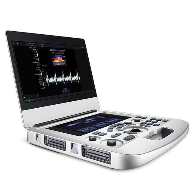 Portable Doppler Ultrasound Machine Laptop Style Color Imaging with Auto Measurements 256 Frames Cine Loop for General Diagnosis