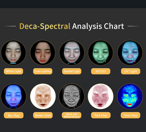 Analizador de Piel con IA y Algoritmo de Aprendizaje Profundo, Sistema de Evaluación de Textura de la Piel para Uso Dermatológico - Product Image 3