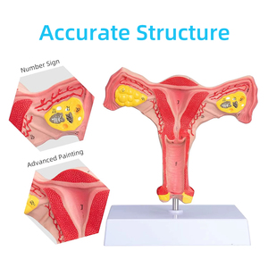 แบบจำลองมดลูกและรังไข่ทั้งสองด้าน แบบจำลองมดลูกหญิง สำหรับสื่อการสอน การเรียนรู้วิทยาศาสตร์การแพทย์ กายวิภาคศาสตร์ แบบจำลองมดลูก - Product Image 5