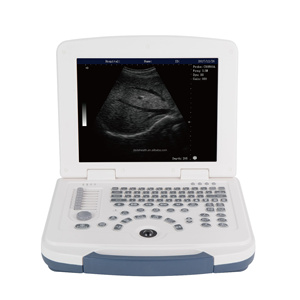 DM CE - Mejor Precio y Venta al por Mayor de Fábrica - Máquina de Ultrasonido Veterinaria Portátil - Escáner de Ultrasonido Clínico para Veterinarios - Product Image 3