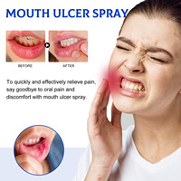 Spray réparateur buccal en marque propre pour soulager les gencives enflammées, les gonflements et les bulles Soins bucco-dentaires