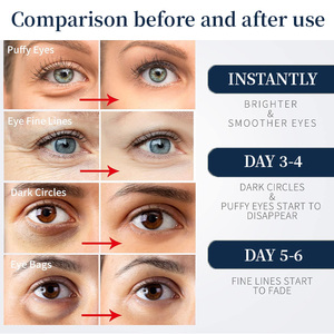 Parches de Gel Bio Orgánicos para Ojos, Antiarrugas y Reafirmantes, con Ácido Hialurónico y Colágeno, Mascarilla de Cristal para Ojos para Piel Seca, Venta al por Mayor - Product Image 3