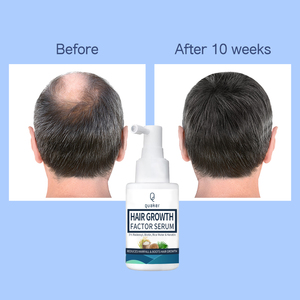 Qquaker Meilleure vente Réparation Follicules 3% Redensyl Croissance Réduire la perte de cheveux <span class=keywords><strong>Spray</strong></span> Sérum capillaire de marque privée - Product Image 4