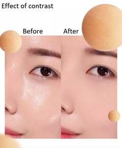 Rodillo de piedra que absorbe el aceite facial, <span class=keywords><strong>lava</strong></span> volcánica de doble punta de plástico - Product Image 6