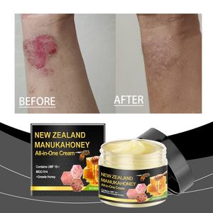 Crème Articulaire au Venin d'Abeille Marque Blanche, Formule Personnalisée Kola pour Soulagement des Rougeurs - Product Image 2