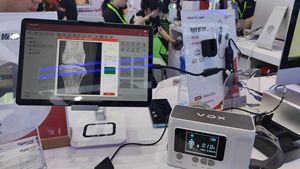 Nueva Llegada: Máquina Portátil de Rayos X Dental Handy 70KV 2mA <span class=keywords><strong>VDX</strong></span> 7020/<span class=keywords><strong>VDX</strong></span> 7030 Clase II para Uso Veterinario y Humano - Product Image 5