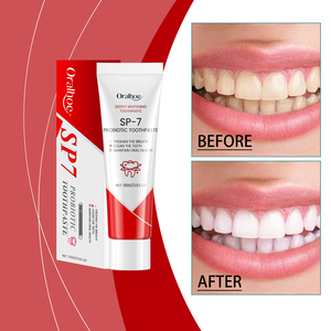 Oralhoe Probiotics kem đánh răng cho răng vệ sinh chăm sóc làm sạch nhẹ kéo dài sự tươi mát hiệu quả trong việc loại bỏ vết bẩn trên bề mặt - Product Image 1