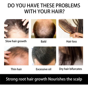 G Suero para el crecimiento del cabello Reduce la caída del cabello Tratamientos para la pérdida de cabello Densidad del cabello para un cabello más grueso y completo para mujeres y hombres - Product Image 3