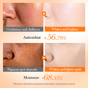 OEM BIOAQUA etiquetas privadas vitamina C blanqueamiento antioxidante nutritivo cuidado de la piel facial 6 piezas conjunto traje caja de regalo para <span class=keywords><strong>mujer</strong></span> - Product Image 4