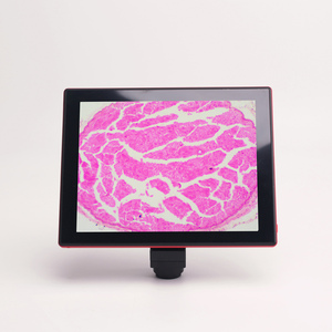 Phenix <strong>LCD</strong> <strong>Microscope</strong> <strong>with</strong> Digital <strong>LCD</strong> <strong>Screen</strong> 9.7inch Touch Pad Built-in 5.0MP <strong>Microscope</strong> Camera - Product Image 1