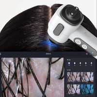 Instrument d'analyse du cuir chevelu et de détection d'image T5 pour les soins capillaires professionnels en salon