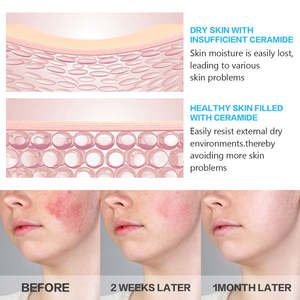 Produit de beauté en marque privée, soin doux pour les pores, anti-âge, apaisant, réparateur, éclaircissant, hydratant, à la portulacée et à la céramide pour la peau du visage - Product Image 4
