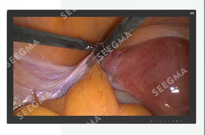 จอแสดงผลสำหรับการผ่าตัดแบบส่องกล้องคุณภาพสูง ขนาด 27 นิ้ว 32 นิ้ว 55 นิ้ว สำหรับใช้ในโรงพยาบาล เครื่องมือไฟฟ้า - Product Image 3