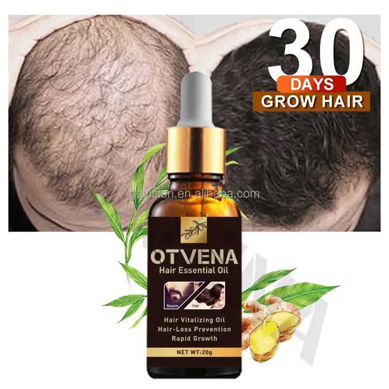 Olio per la crescita dei capelli OEM con erbe e biotina-olio per la crescita dei capelli per una maggiore, più spessa, più lunga