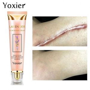 Yoxier品牌面部护理修复霜淡斑薰衣草疤痕去除纹身霜妊娠纹霜 - Product Image 2