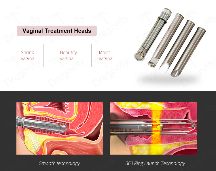 mini rf skin tightening