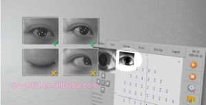EOBIO12 ZEISS tarihi veri ithalat fonksiyonu ile en popüler ucuz kinetik projeksiyon çevre optik görsel alan analizörü - Product Image 6