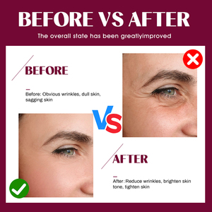 Suero Facial con Ácido Hialurónico AQUA, Ácido Hialurónico Azul VC, Péptido Líquido Puro, Hidratante, Reparador, Renovador de la Piel, OEM Privado - Product Image 5