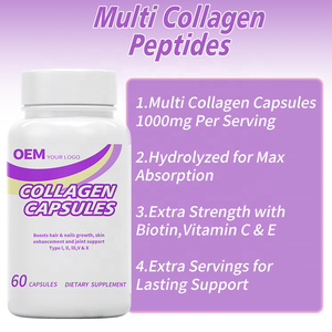 Cápsulas de Colágeno Premium OEM con Biotina, Queratina y Ácido Hialurónico, Suplemento para la Elasticidad y Blanqueamiento de la Piel para Mujeres - Product Image 3