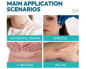 Feuilles imperméables invisibles de patch de cicatrice hydrocolloïde pour la protection de couverture de peau avec le port confortable durable - Product Image 3