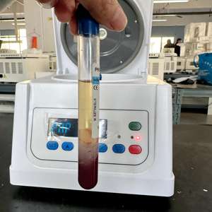 Prix de gros <span class=keywords><strong>ACD</strong></span>+GEL Tubes en plastique et en verre pour centrifugation 10ml <span class=keywords><strong>12ml</strong></span> <span class=keywords><strong>Kit</strong></span> de tubes centrifuges OEM - Product Image 1