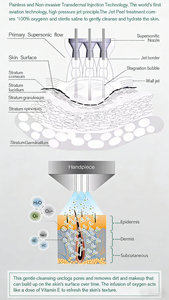 Nouveauté : Appareil de peeling à jet d'eau oxygénée non invasif pour <span class=keywords><strong>le</strong></span> visage, les lèvres, les yeux, <span class=keywords><strong>le</strong></span> corps, rajeunissement de la peau et <span class=keywords><strong>éclat</strong></span> radieux - Product Image 2