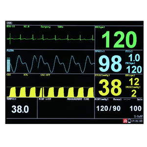 Monitor tanda Vital suhu anestesi medis dokter hewan multi parameter Monitor hewan portabel - Product Image 4