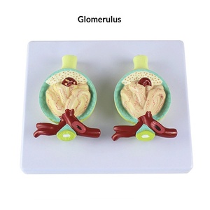 Modelo de anatomía renal ampliado, glándulas suprarrenales, riñón enfermo, modelo anatómico de órgano interno humano para escuelas de ciencias médicas - Product Image 6