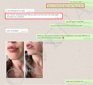 Chăm Sóc Da Mặt Tốt Nhất Vitamin E Kem Dưỡng Ẩm Làm Trắng Da Chống Lão Hóa Kem Mặt - Product Image 3