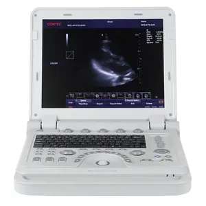 CONTEC CMS1700A Doppler couleur 4d échographie vasculaire ultrasonique Doppler machine echografie toestel