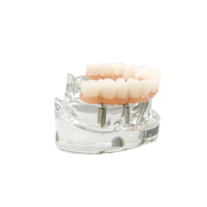Modelos Dentales de Resina a Precio de Fábrica, Modelos de Implantes Dentales Maxilares y Dentaduras Postizas Reutilizables para Entrenamiento y Uso Educativo - Product Image 2