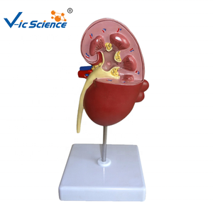 Modelo Anatómico de Riñón con Quiste Renal, Modelo de Anatomía Humana para Enseñanza Médica, Equipo de Patología Renal para Modelo de Quiste Renal - Product Image 6