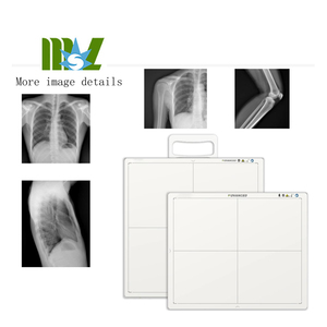 Radiografía digital 17*17 Detector de panel plano de rayos X inalámbrico digital para sistema <span class=keywords><strong>DR</strong></span> - Product Image 4