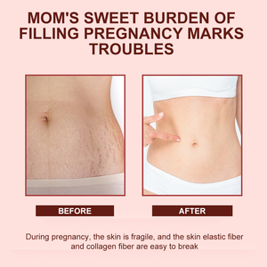 Bán buôn 500ml massage cơ thể & Sửa chữa da dầu thực vật dựa trên cần thiết căng đánh dấu loại bỏ dầu cho vết rạn da cơ thể & chăm sóc da - Product Image 2