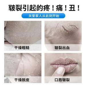 มิอาวฉี หลิง วาสลีนเกรดทางการแพทย์ 50 มล. 500 มล. ครีมบำรุงมือ ลิปบาล์ม น้ำมันหล่อลื่น - Product Image 2