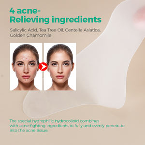 แผ่นแปะสิวไฮโดรคอลลอยด์สำหรับใบหน้า ยี่ห้อส่วนตัว แผ่นแปะสิวแบบใสสำหรับหน้าผาก - Product Image 3