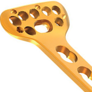 Instrumentos Manuales de Fijación Ósea de Acero Inoxidable de Alta Calidad 2026: Placas Ortopédicas Premium para Cirugía - Product Image 6