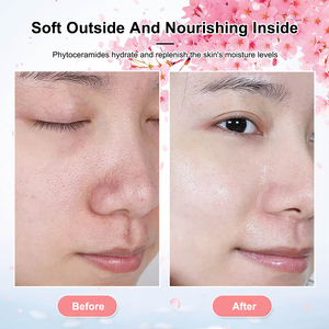 Tùy Chỉnh Nhật Bản <span class=keywords><strong>Sakura</strong></span> Bộ Chăm Sóc Da Phytoceramide Dưỡng Ẩm Giữ Ẩm Sửa Chữa Kem Mắt Huyết Thanh Tinh Chất Kem OEM OBM Odm - Product Image 3