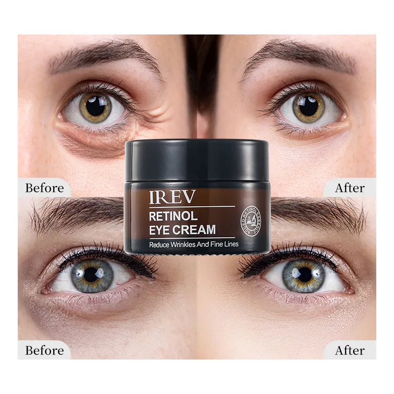 OEM Großhandel Private Label IREV Hautpflege produkte Falten reduzieren Augenringe entfernen Feuchtigkeit creme 30g Retinol Augen creme