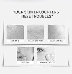 มาส์กหน้าโคลนแม่เหล็กโคลนโคลนกระชับรูขุมขนกระชับรูขุมขนสินค้าดูแลผิวฉลากส่วนตัว - Product Image 6